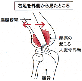 図解：炎症が起こるメカニズム